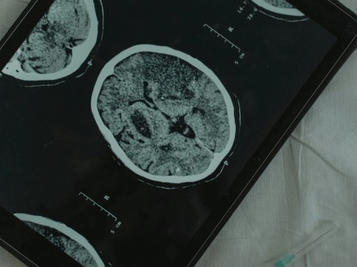 Neuroscience