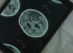 Neuroscience